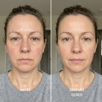 SEREN - Ritual Linfático